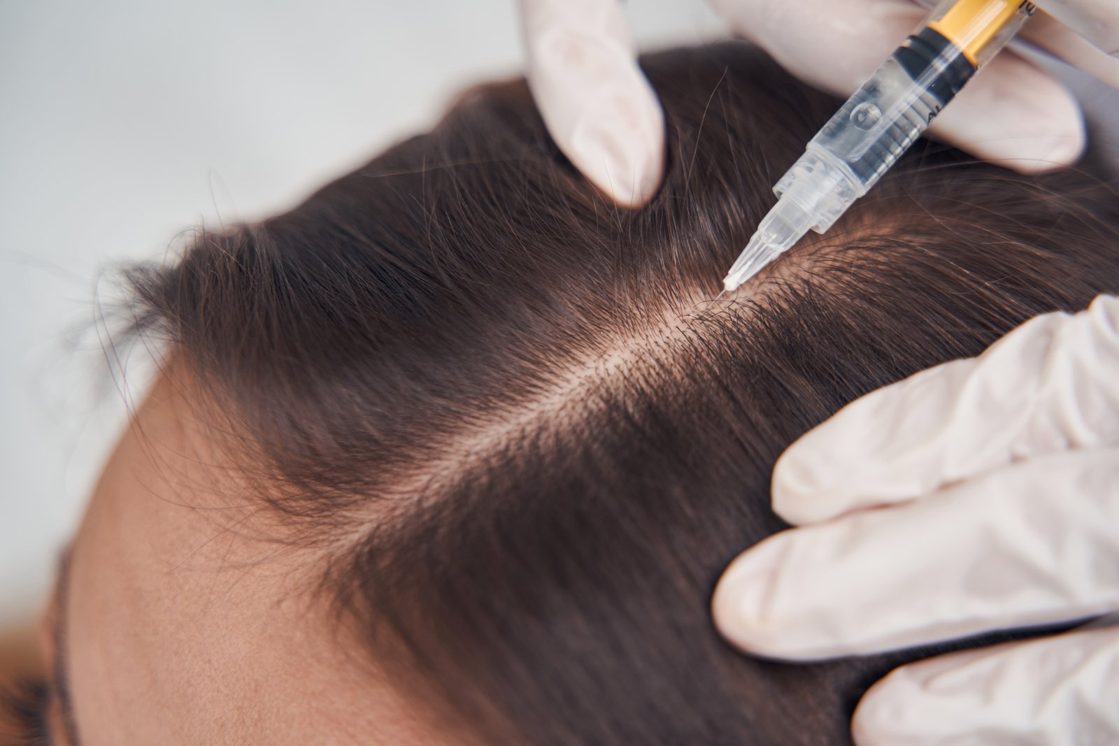 non-surgical-hair-treatments