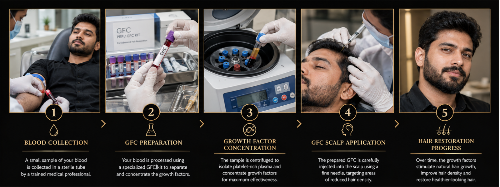 GFC Process