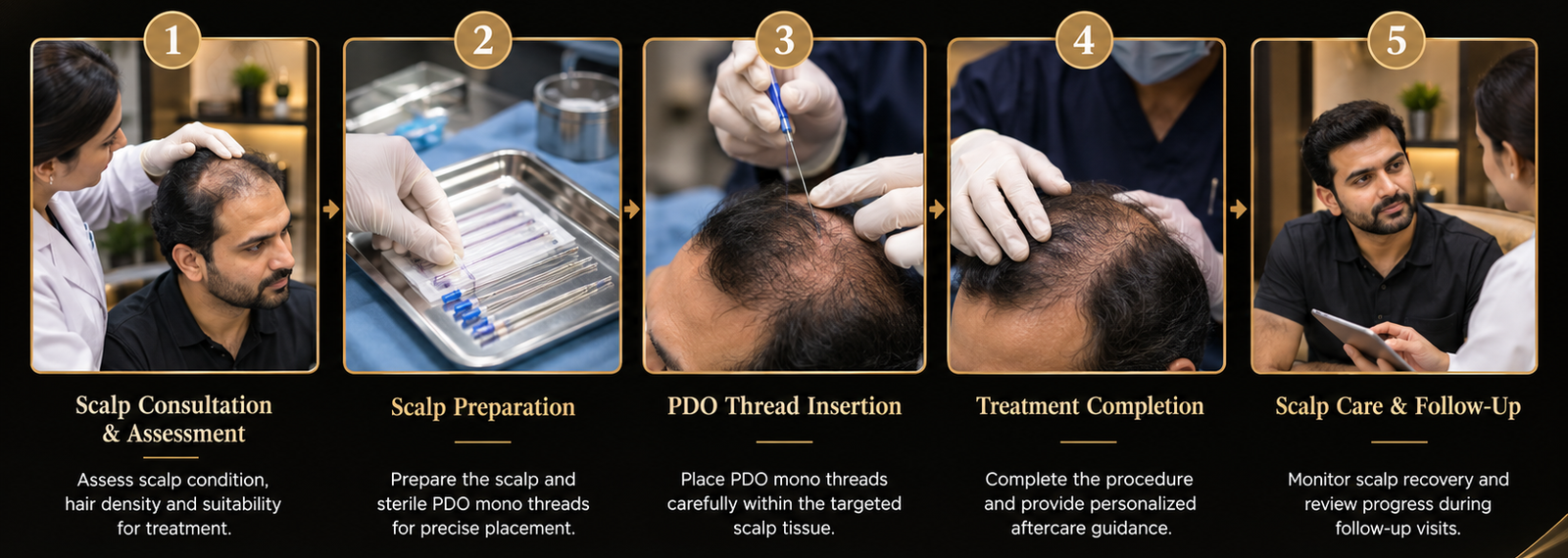 GFC Process